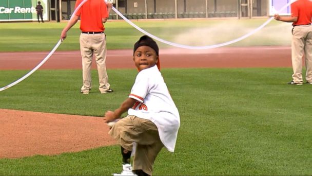 First Kid To Receive Dual Hand Transplant Throws First Pitch At 