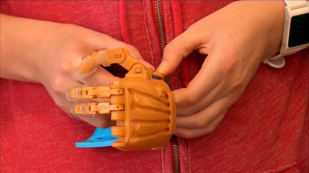 Video Middle Schoolers Using 3-D Printer to Create Prosthetic Hand - ABC  News