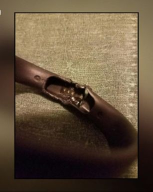 VIDEO: Dina Mitchell said she had owned her Fitbit Flex 2 for about two weeks when the fitness tracking device allegedly caught fire on her arm while she was reading a book on Tuesday night.