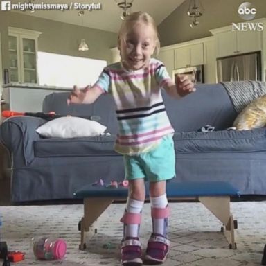 VIDEO: 'I'm walking!' 4-year-old with cerebral palsy takes first steps on her own