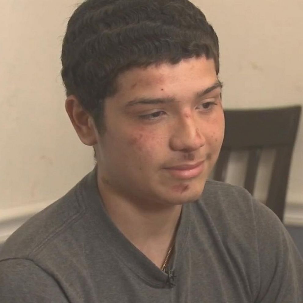 Family accuses Indiana officers who restrained teen of going too far: 'I  was trying to break free because I couldn't breathe' - ABC News