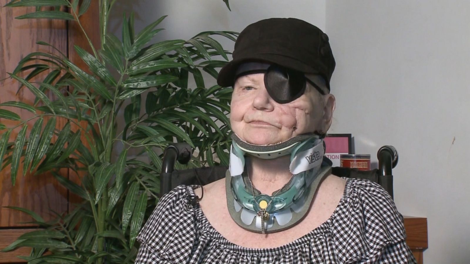 71 year old woman injured severely in bear attack recounts the