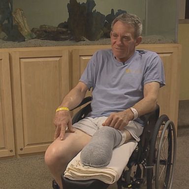 PHOTO: Kurt Kaser amputated his leg after getting stuck in farming equipment with no one around to help. 