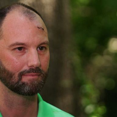 Josh McClatchy knew finding water would be a problem if he was to survive after getting lost in the Arkansas woods last week. He did not anticipate the ants.