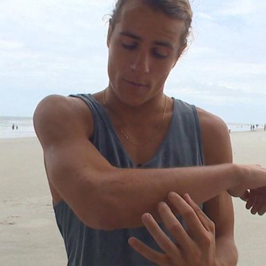 Frank O'Rourke, 23, said he was surfing at Jacksonville Beach Saturday when a shark jumped out of the water and bit him.