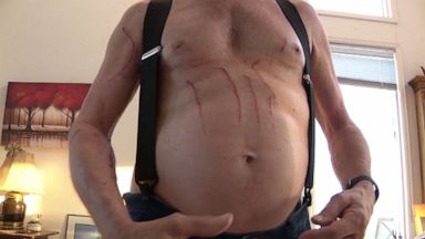 911 Call Captures Couple Battling Bears That Broke Into Their House Video Abc News