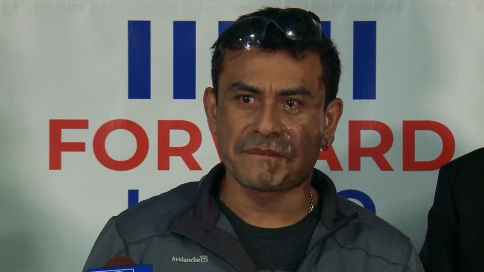 Video Hispanic Man Has Acid Thrown In Face In Alleged Hate Crime Abc News