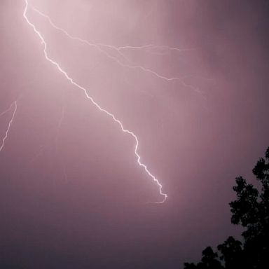 Hundreds of people are severely hurt each year from lightning strikes, according to the National Weather Service.