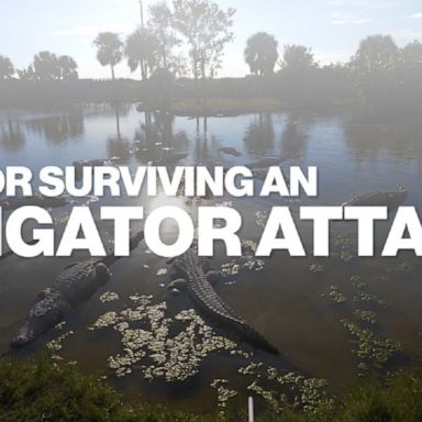 Top tips for protecting yourself from a gator attack.