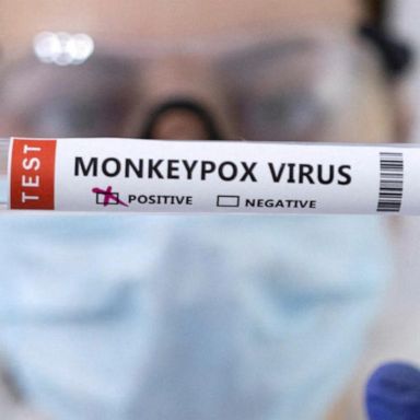 ABC News spoke with experts to determine the best steps to take in order to reduce your risk of catching the virus. 