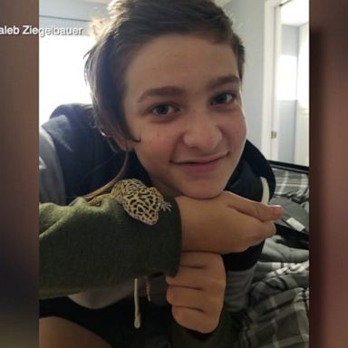 Caleb Ziegelbauer, 13, was treated for a disease caused by the Naegleria fowleri amoeba that destroys brain tissue.