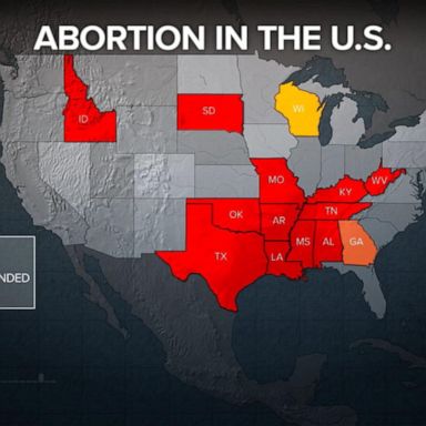 VIDEO: House's Republican majority passes 2 anti-abortion measures 