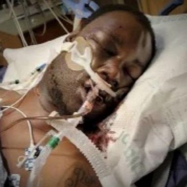 The medical examiner's official autopsy report for Tyre Nichols showed he "died of brain injuries from blunt force trauma," the DA's office told Nichols' family Tuesday.