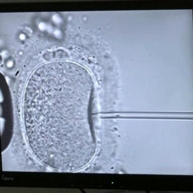 VIDEO: Alabama doctors freeze operations after IVF ruling