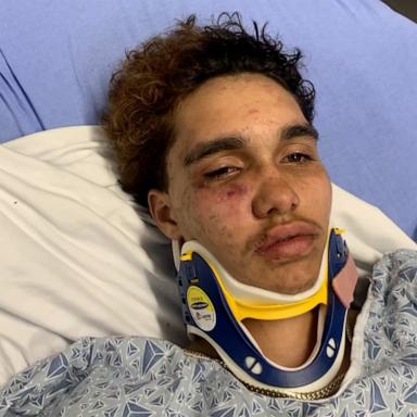 A trans teenager was allegedly assaulted by a group of other teens in Massachusetts, and police are investigating it as a possible hate crime.