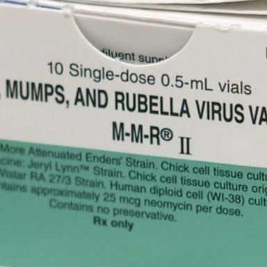 VIDEO: Doctor discusses efforts to mitigate the outbreak of measles in Texas