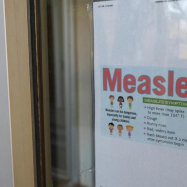 VIDEO: Measles cases now in 9 states as Texas outbreak grows