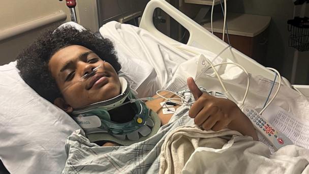 ‘I’m pretty lucky’: Teen struck by lightning as thunderstorms hit Northeast