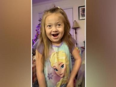 WATCH:  Girl with rare disease spreads joy