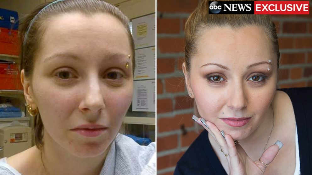 PHOTO: Amanda Berry is pictured here after police rescued her, left, and today.
