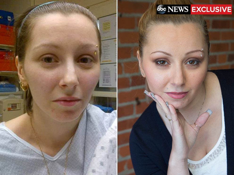 PHOTO: Amanda Berry is pictured here after police rescued her, left, and today.