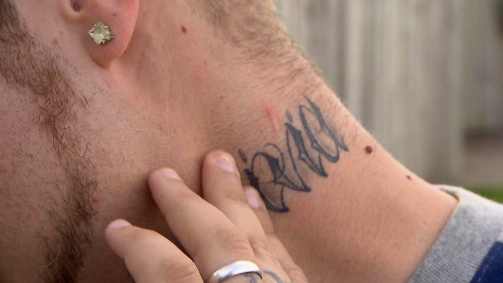PHOTO: Michael Babcock points to a scar on his neck where he said Daron Wint stabbed him in June 2007.