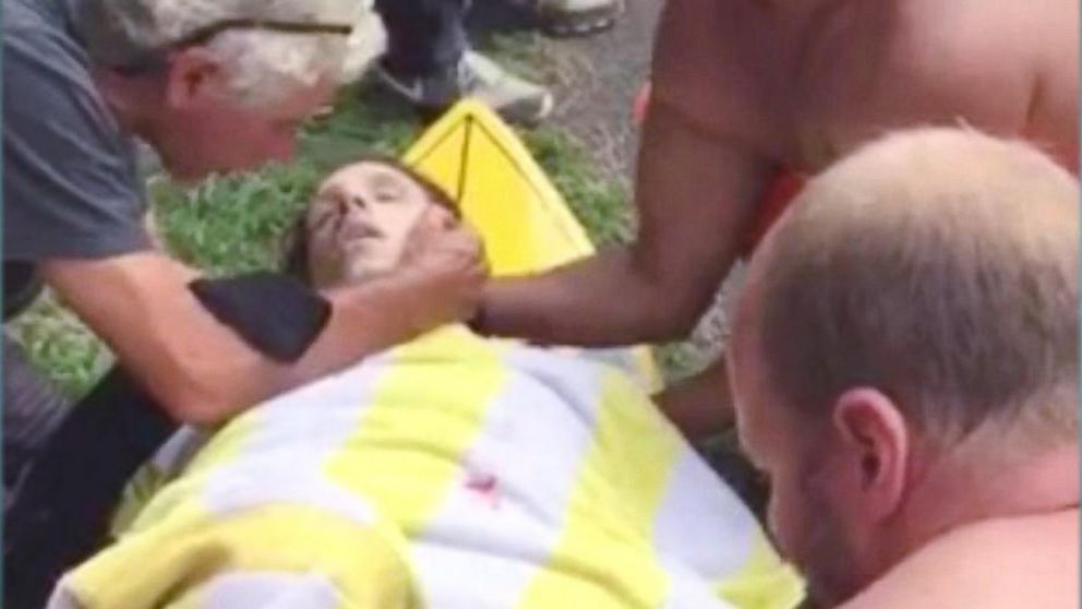 This image shows a 25-year-old surfer who was bitten by a shark on Oct. 9, 2015 while surfing near Oahu's North Shore in Hawaii. ABC affiliate KITV in Honolulu identified him as Colin Cooks.