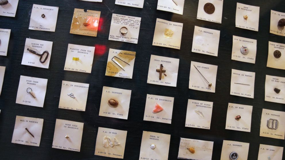 A variety of items ingested by children, from a sardine can key to a crucifix, are displayed at Boston Children's Hospital in Boston, June 8, 2016.
