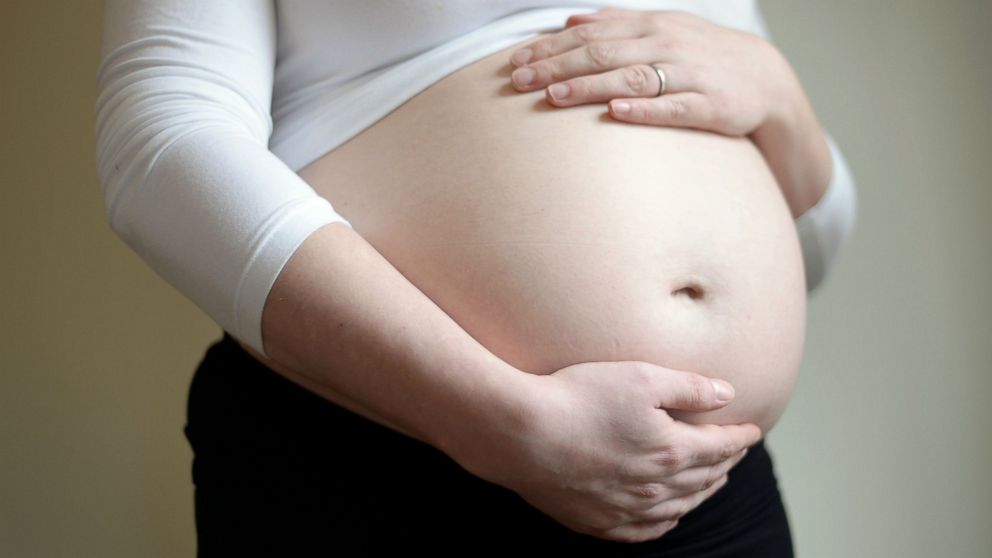 A file photo dated Jan. 4, 2014 shows a pregnant woman.