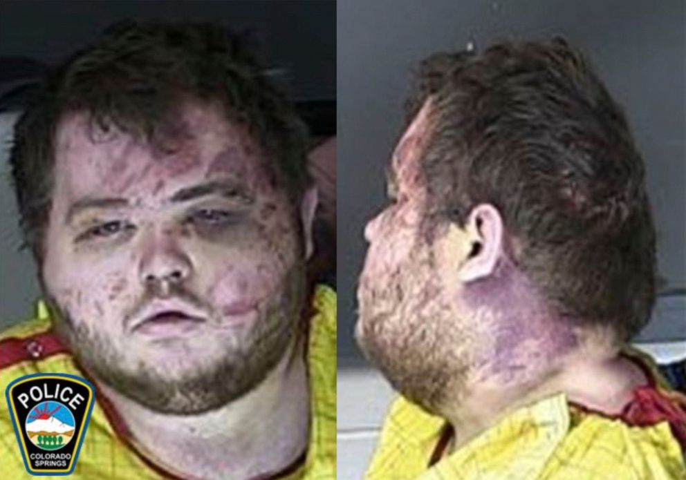 PHOTO: This booking photo provided by the Colorado Springs, Colorado Police Department shows Anderson Lee Aldrich.  Aldrich.