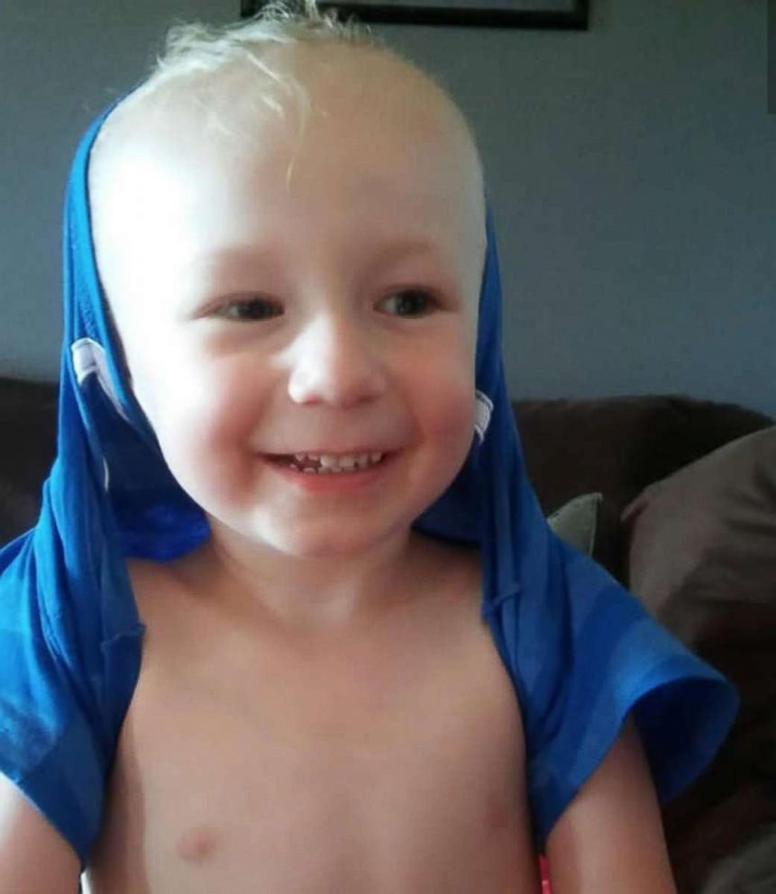 PHOTO: Camdyn Carr, 3, has been battling acute flaccid myelitis (AFM) since he was diagnosed two months ago.