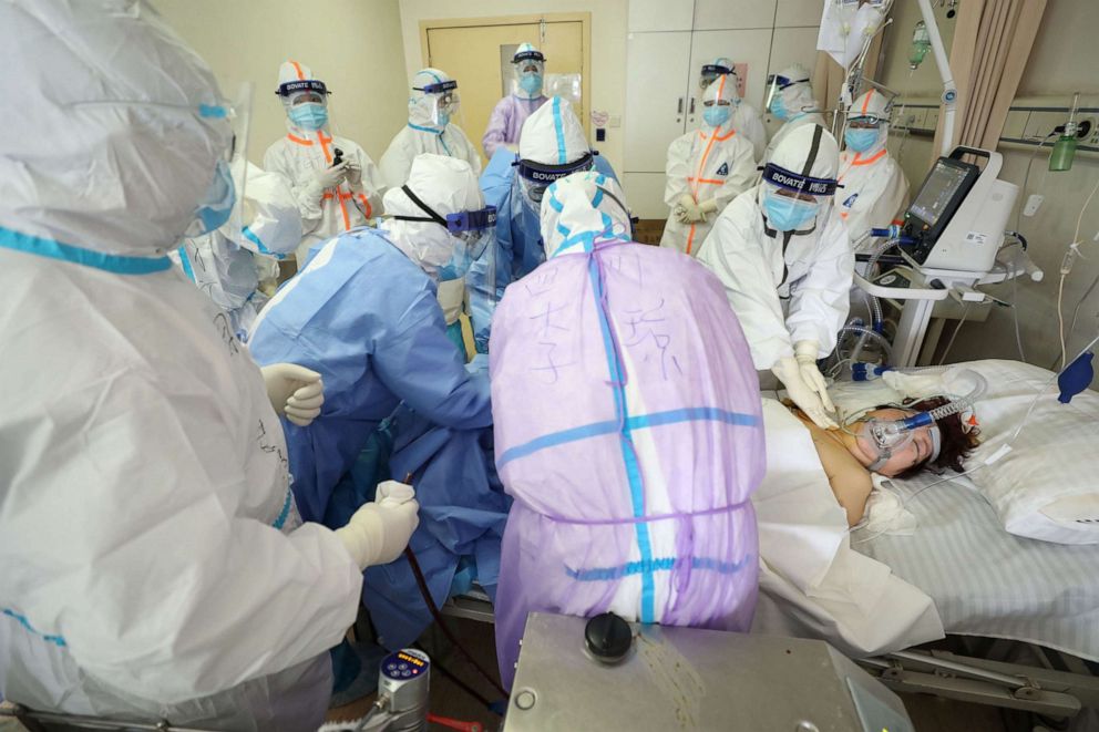 PHOTO: Medical staff treating a critical patient infected by the COVID-19 coronavirus with an Extracorporeal membrane oxygenation (ECMO) at the Red Cross hospital in Wuhan in China's central Hubei province on March 1, 2020.