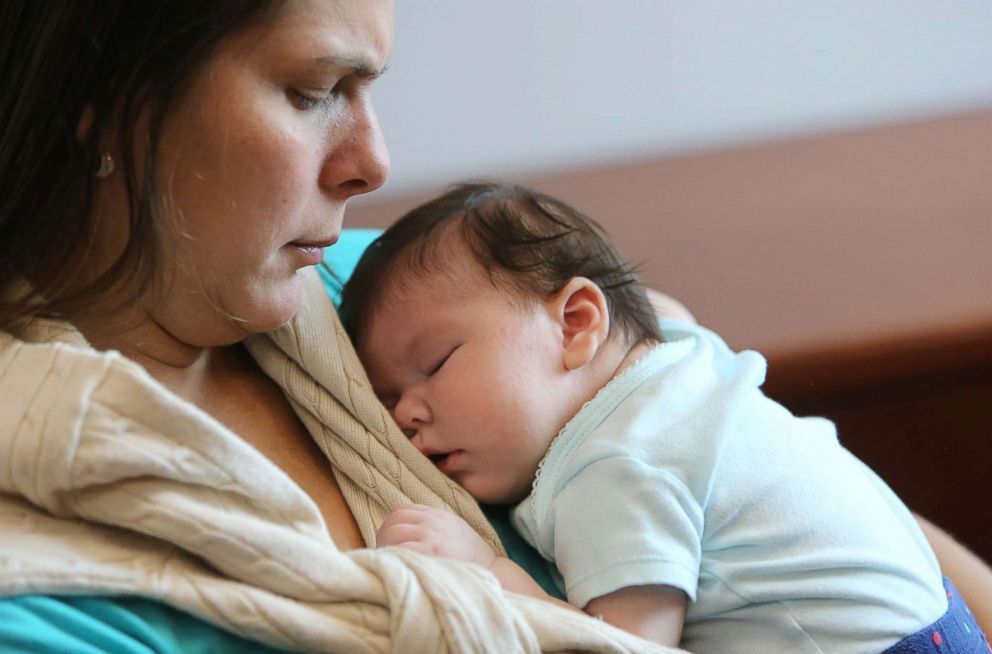 PHOTO: Maria Ramirez Bolivar, a Venezuelan woman who lives in Doral, Florida, but contracted Zika in her first trimester while traveling in Venezuela, holds her baby girl, Micaela Milagros Mendoza, 2-months, Aug. 24, 2016.