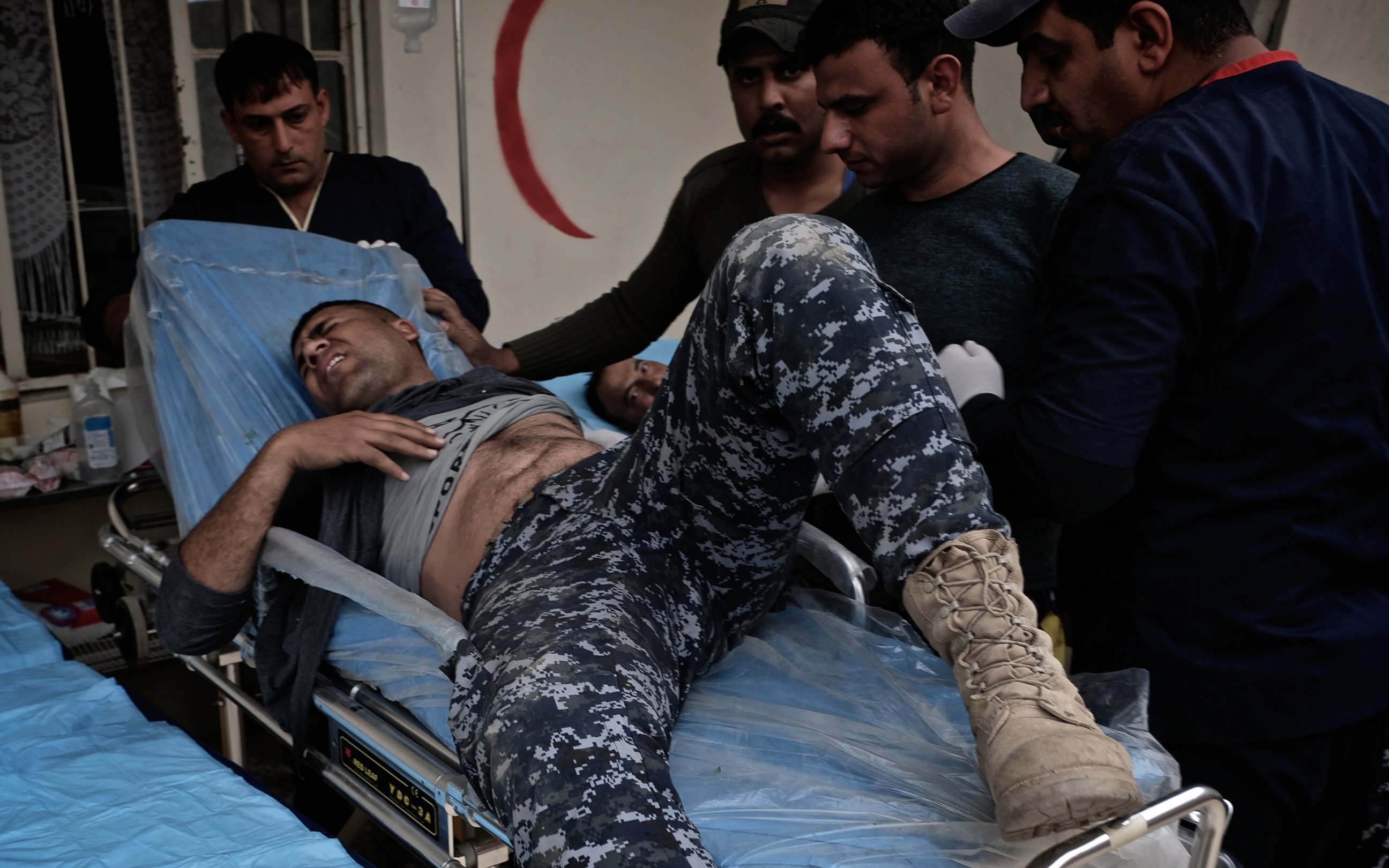 PHOTO: An police officer is badly wounded with burns from an ISIS suicide car bomb attack in the Mahallat al Jawsaq neighborhood of Mosul, Iraq on March 1, 2017.