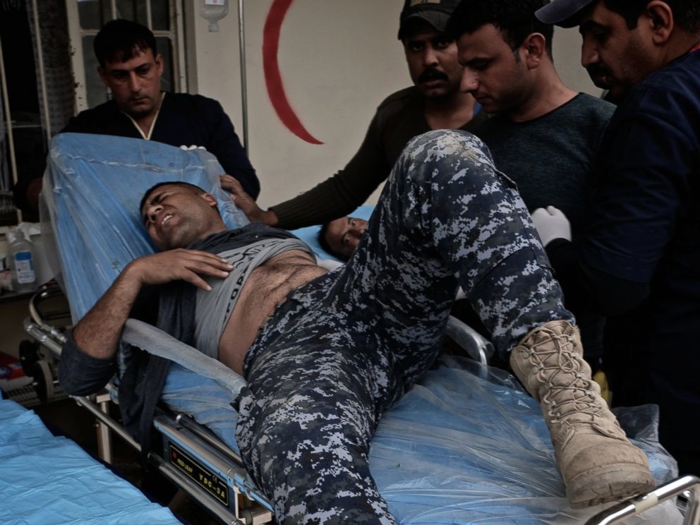 PHOTO: An police officer is badly wounded with burns from an ISIS suicide car bomb attack in the Mahallat al Jawsaq neighborhood of Mosul, Iraq on March 1, 2017.