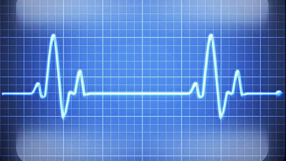 Iowa Students to Wear Heart Rate Monitors - ABC News