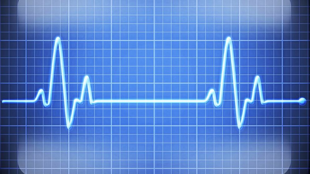 heart monitor lines