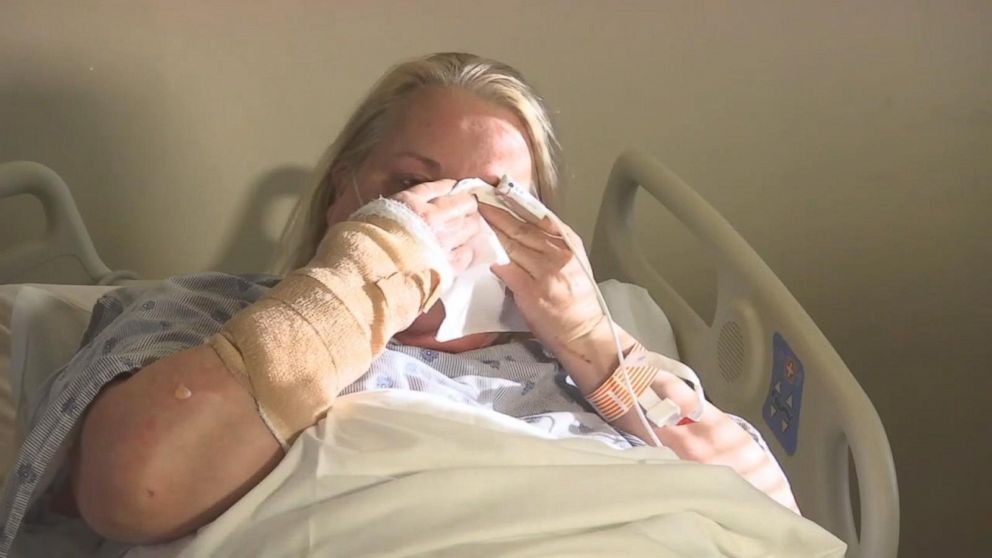 PHOTO: Debbie Brooks, a survivor of the Tennessee wildfires in the city of Gatlinburg, shared her harrowing story of how from her hospital bed on Dec. 1, 2016. 