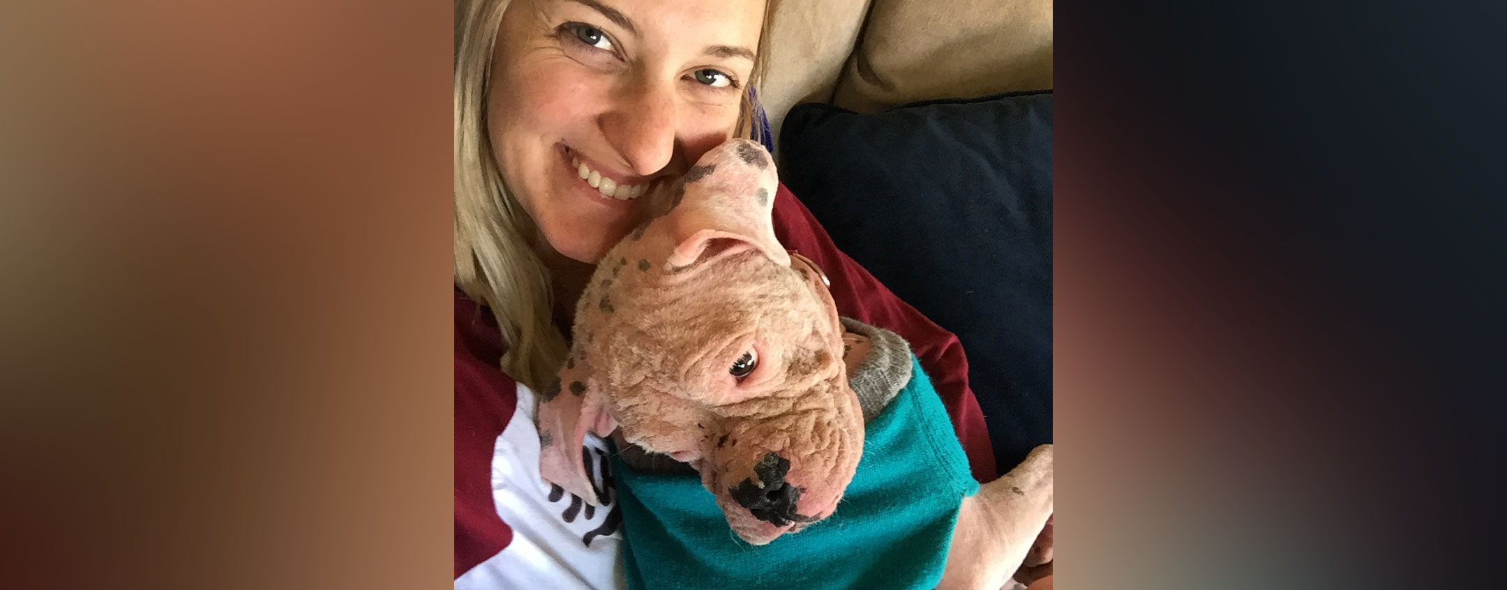 PHOTO: Jillian Ryan and her family adopted a rescue dog, Asia, who was abandoned while suffering from an infection that turned her skin pink.
