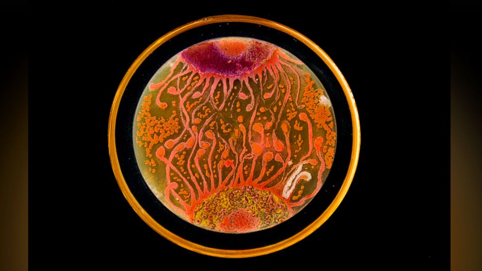 PHOTO: "Cell to Cell" by microbiologists Mehmet Berkmen and Maria Penil from Massachusetts won the "People's Choice" award in the American Society of Microbiology's 2015 Agar Art Contest.