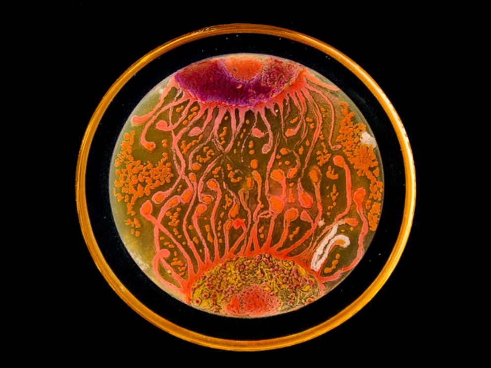 PHOTO: "Cell to Cell" by microbiologists Mehmet Berkmen and Maria Penil from Massachusetts won the "People's Choice" award in the American Society of Microbiology's 2015 Agar Art Contest.