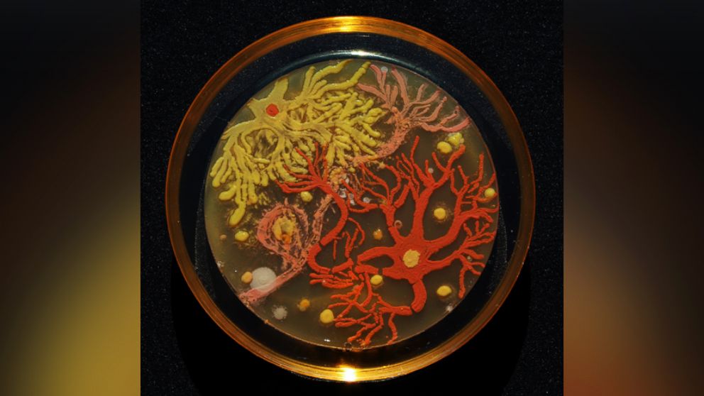 PHOTO: "Neurons" by microbiologists Mehmet Berkmen and Maria Penil from Massachusetts won first place in the American Society of Microbiology's 2015 Agar Art Contest.