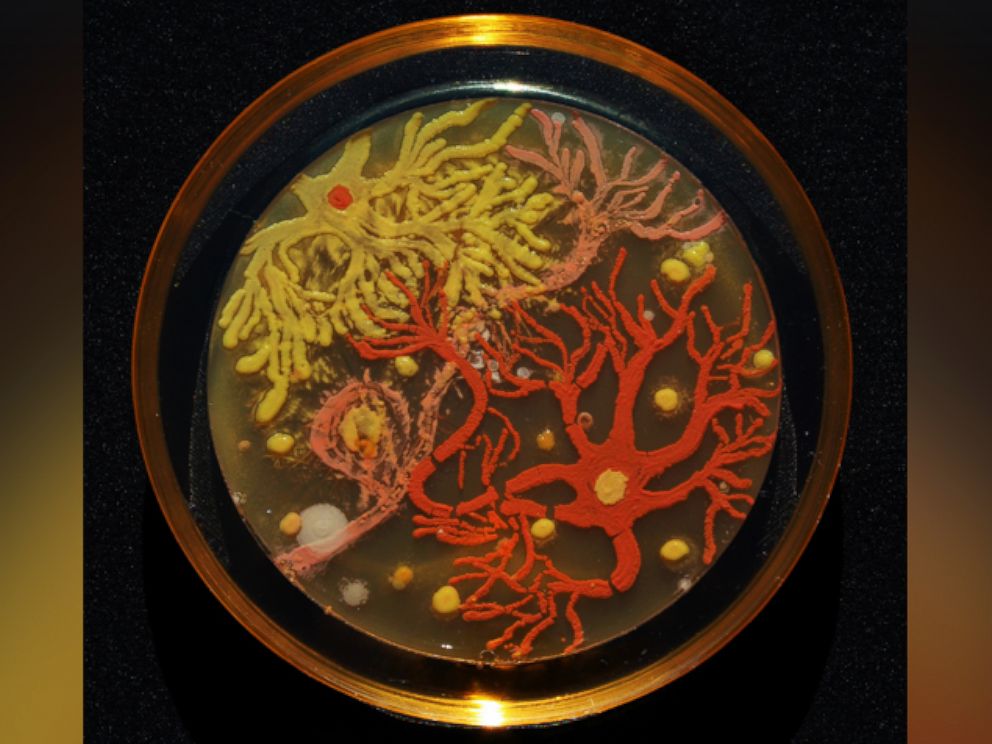 PHOTO: "Neurons" by microbiologists Mehmet Berkmen and Maria Penil from Massachusetts won first place in the American Society of Microbiology's 2015 Agar Art Contest.