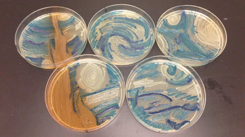 Microbiologist Melanie Sullivan of Missouri recreated Vincent van Gogh's "The Starry Night" for the American Society of Microbiology's 2015 Agar Art Contest.