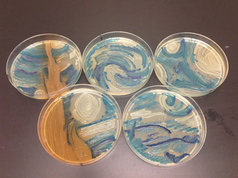 PHOTO: Microbiologist Melanie Sullivan of Missouri recreated Vincent van Gogh's "The Starry Night" for the American Society of Microbiology's 2015 Agar Art Contest.