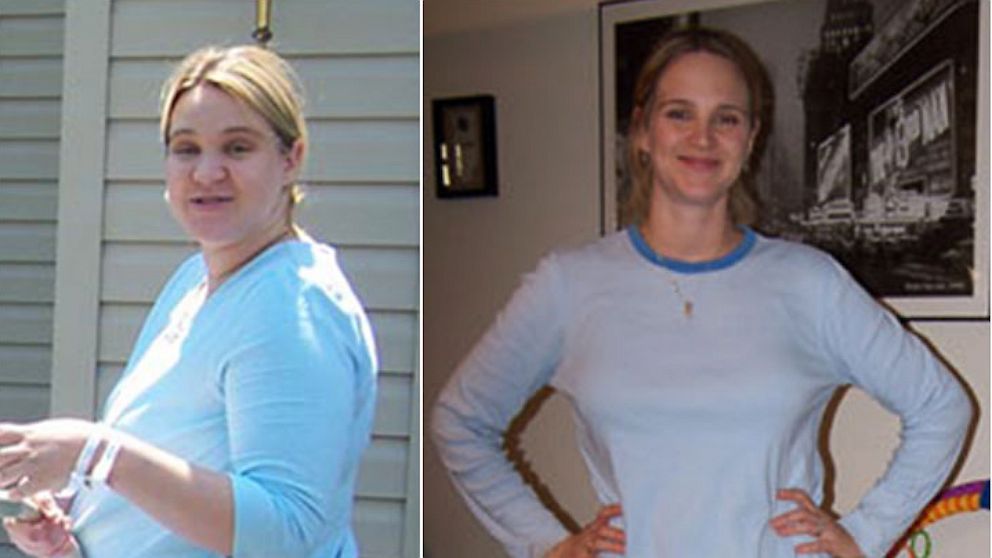 Roni Noone claims a diet company used her weight loss photos without her consent to promote a weight loss product.