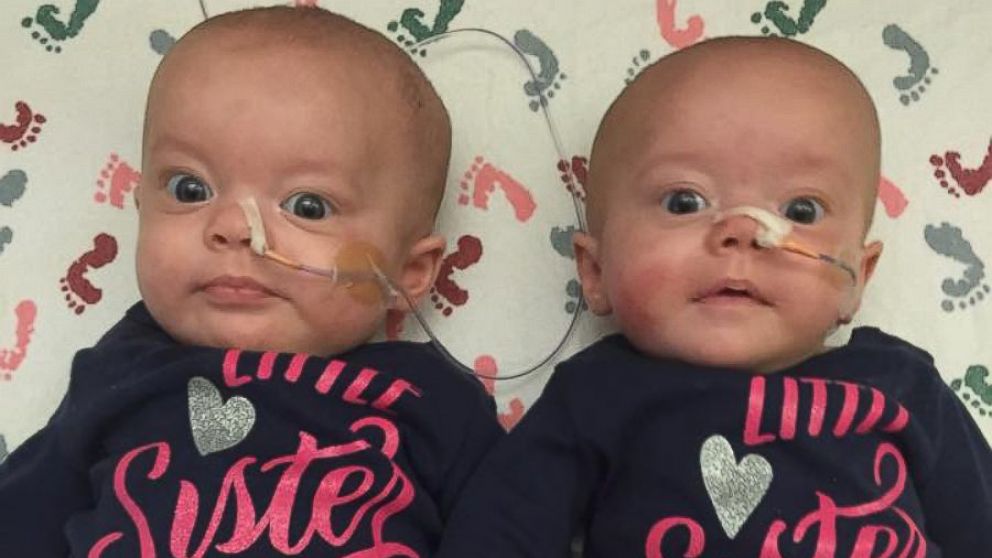 PHOTO: Twins Kenedi and Kendal Breyfogle were both diagnosed with leukemia August 17.