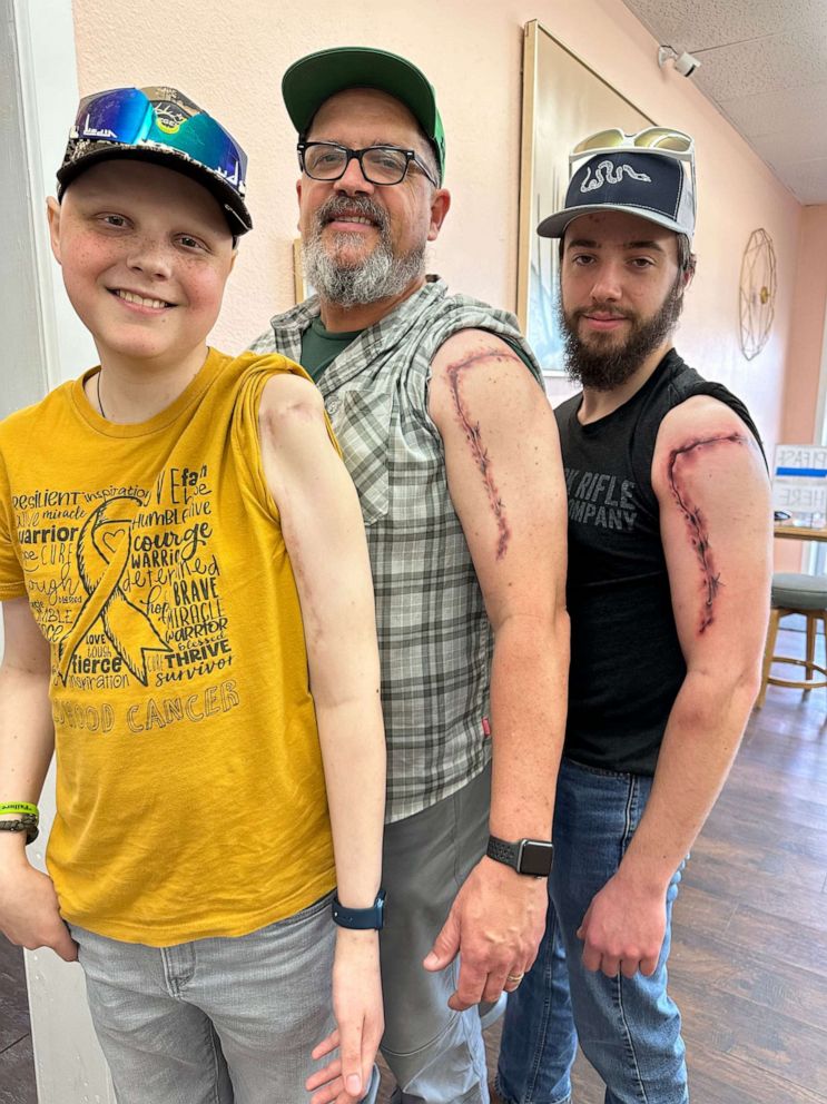 PHOTO: Jody O'Briant (center) and his eldest son, Nathan (right), both received tattoos along their left arms. The tattoos match the scar O'Briant's youngest son Jasper has from his cancer treatment.