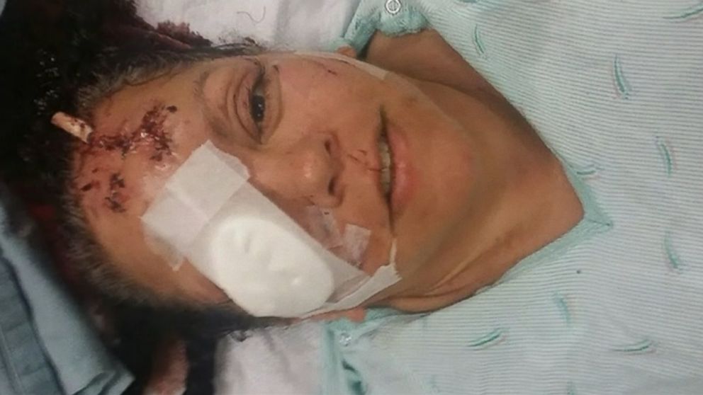 PHOTO: A Washington grandmother and grandson were attacked by an otter while swimming in a watering hole.
