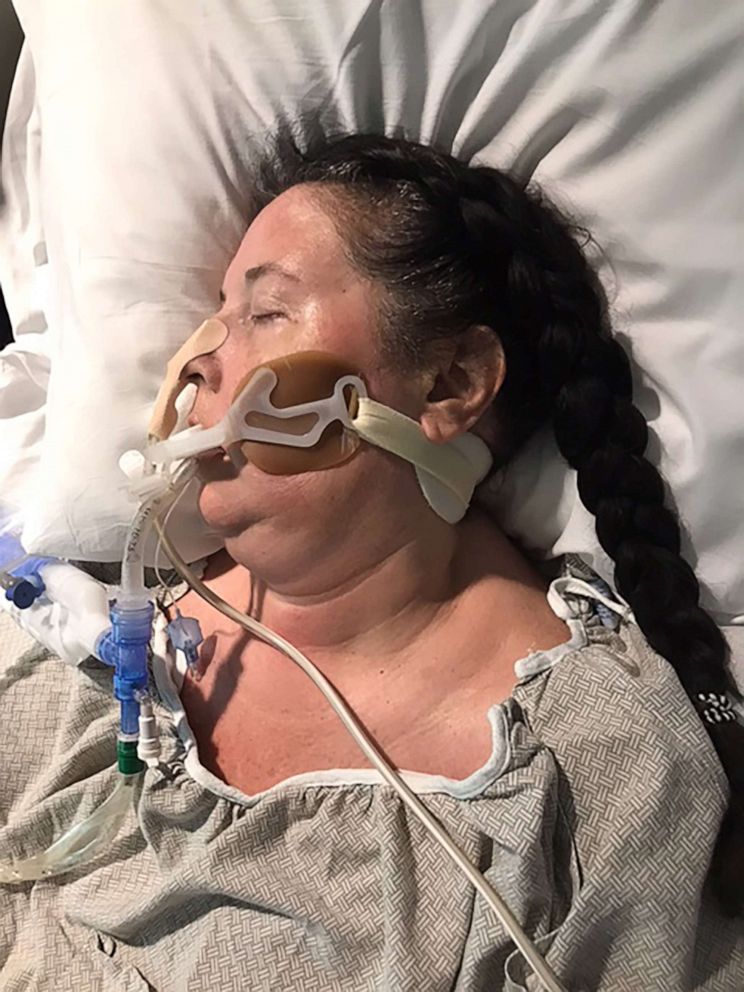 PHOTO: Blackshear, Georgia, resident Lisa Martin, 50, was placed under a ventilator and in a coma for months after she was diagnosed in September 2020.